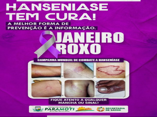 Janeiro Roxo: Fique atento aos principais sintomas da hanseníase